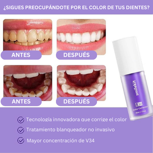 Blanqueador Dental | Edicion Limitada ™Auri Care 2024